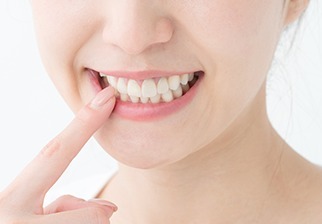 (3)フッ素塗布