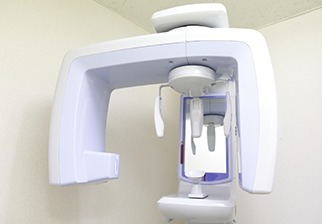 (1)診察・レントゲン